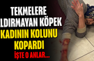 Tekmelere aldırmayan köpek kadının kolunu kopardı