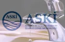 ASKİ Ankara su kesintisi | 9 AĞUSTOS ANKARA SU KESİNTİSİ