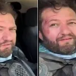 Fenomen Ömer Başdoğan (Nalet Bebe) motosiklet kazası geçirdi