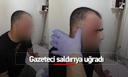 Gazeteci saldırıya uğradı