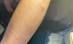 Siirt'te oto sanayisinde sokak köpeklerinin saldırdığı genç yaralandı