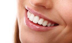 Evde doğal diş beyazlatma yöntemi