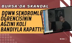 Bursa’da Skandal Down Sendromlu Öğrencisinin Ağzını Koli Bandıyla Kapattı!!