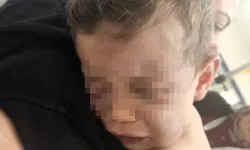 Darp Edilen 2 Yaşındaki Bebek Devlet Korumasına Alınacak!