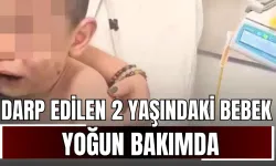 Annesinin Erkek Arkadaşı Tarafından Darp Edilen 2 Yaşındaki Bebek Yoğun Bakımda