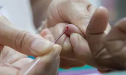 Bu Hastalıkta Erken Teşhis Hayat Kurtarıyor! Tasami Nedir, Nasıl Anlaşılır?