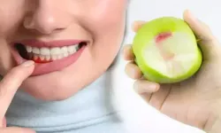 Diş Fırçalarken yada Uyandığınızda Diş Etiniz Kanıyorsa Sebebi Ne Olabilir? Diş Eti Kanamasının En Sık Görülen Nedenleri