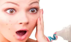 Sivilceye Diş Macunu Sürmek Gerçekten Geçirir mi? Bu Yöntemin Faydası Var mı, Yoksa Cilde Zarar Verir mi?