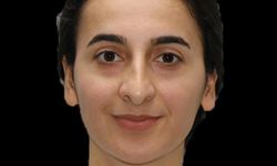 Tedavi gören polis memuru Burcu Ertem vefat etti