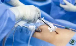 SAFRA KESESİ AMELİYATI (KOLESİSTEKTOMİ) NEDİR, SONRASINDA VÜCUDUNUZDA NE GİBİ DEĞİŞİKLİKLER OLUR?