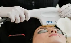 BBL Lazer Nedir, Ne İşe Yarar, Nasıl Uygulanır, Yan Etkileri Nelerdir?
