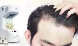 Regenera Activa Tedavisi Nedir ve Saç Dökülmesini Önlemede Nasıl Etki Sağlar?