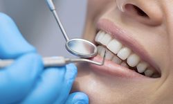 Restoratif Diş Tedavisi Nedir, Hangi Durumlarda Uygulanır ve Kimler İçin Önemlidir?