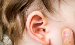Kulak Nezlesi Nedir? Belirtileri Nelerdir ve Tedavi Edilmezse Ne Gibi Sorunlara Yol Açar?