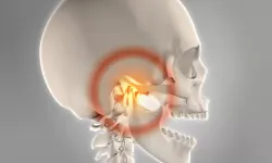 Çene Kayması Nedir? Neden Olur, Nasıl Anlaşılır ve Hangi Belirtilerle Kendini Gösterir?