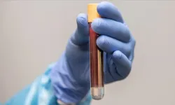 Sadece Kan Testiyle Kanser Tespiti Mümkün Mü? Volition’un Yeni Yöntemi Umut Veriyor