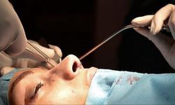 Burun Ameliyatı Sonrası Nelere Dikkat Edilmeli? İşte İyileşmeyi Hızlandıran 8 Altın Kural!