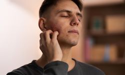 Neden Vücudumuzda Sivilce Çıkar? Akne Sivilce Tedavi Yöntemleri ve Sivilce İzleri İçin Etkili Çözümler