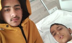 Ankara’da sokak köpeğinin saldırısına uğrayan çocuk yaralandı