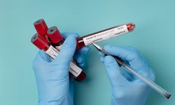 Kan Neden Pıhtılaşır? Kan Pıhtılaşmasına  Ne İyi Gelir? Pıhtılaşma Olmasaydı Ne Olurdu?