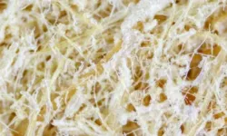 Selüloz Nedir, Hangi Besinlerde Bulunur ve Vücuda Ne Fayda Sağlar?