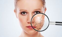 Soğuk hava cildi sessizce yıpratıyor