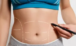 Karın Germe Ameliyatı ile Özgüveninizi Yeniden İnşa Edin