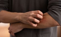 Vücudumuzda Kaşıntı Neden Olur? Kaşıntıya Ne İyi Gelir? Kaşıntılara Karşı Evde Pratik Çözümler