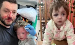 Yalova’da Komşu Kavgası: Babanın Burnu, 14 Aylık Bebeğin Kafatası Çatladı