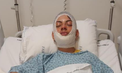 Ateşe benzin döktü, facianın eşiğinden döndü