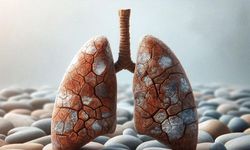 Dünya Tüberküloz Verem Günü | 24 Mart Ne Günü? 24 Mart Dünyada ve Türkiye’de Ne Günü? 24 Mart Ne Burcu?