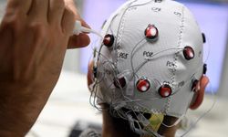 Felçli Hastalar İçin Tarihi Adım! Çin’den Dünyada İlk Kez Ticari Beyin İmplantı Onayı