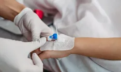 Hastanelerde Sıkça Kullanılıyor Ama Pek Bilinmiyor! Kanül Nedir, Vücuda Neden Takılır ve Hangi Türleri Bulunur?