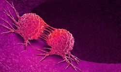 Kanser Riskini Azaltmak Mümkün Mü? Uzmanlara Göre Günlük Hayatta Yapılabilecek 10 Önemli Alışkanlık!