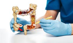 Uzmanlardan Kritik Uyarı! Ailede Kolon Kanseri Varsa Taramaya 10 Yıl Daha Erken Başlayın