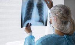 Akciğer Kanserinin Büyük Kısmı Önlenebilir Mi? Uzmanlar Uyardı! Bu Alışkanlık Hayat Kurtarıyor