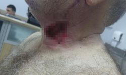 At sahibini boğazından ısırarak ağır yaraladı