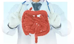 Bağırsak Düğümlenmesi Nedir, Neden Olur ve Belirtileri Nelerdir? Hayatı Tehdit Edebilir mi?