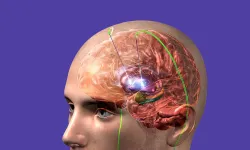 Beyin Pili Nedir, Kimlere Takılır ve Gerçekten Hayatı Nasıl Değiştirir? İşte Merak Edilen Tüm Detaylar!