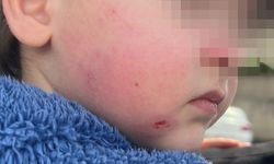 Bursa'da kreşe bıraktığı çocuğunu darp edilmiş halde aldı