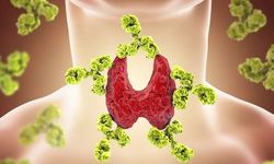 Hashimoto Hastalığı Nedir, Belirtileri Nelerdir ve Bu Sinsi Hastalıktan Korunmak İçin Hangi Alışkanlıklar Hayat Kurtarır