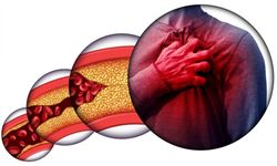 İyi ve Kötü Kolesterol Arasındaki Fark Nedir, Hangisi Sessizce Damarları Tıkıyor?