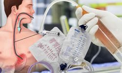 Mide Yıkanması Nedir, Hangi Durumlarda Yapılır ve Gerçekten Hayat Kurtarır Mı?