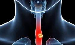 Motilite Nedir, Vücuttaki Hareket Sistemi Bozulursa Ne Olur, Hangi Belirtiler Ortaya Çıkar?