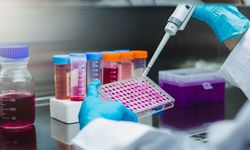 ELISA Testi Nedir? Neden Yapılır, Hangi Hastalıkları Gösterir?