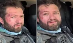 Fenomen Ömer Başdoğan (Nalet Bebe) motosiklet kazası geçirdi