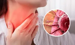 Lenf Kanseri Nedir? Belirtileri, Risk Faktörleri, Teşhis ve Tedavi Yöntemleri