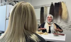 12 yaşında saçlarını ve kulaklarını kaybetti, şimdi kadınlara umut oluyor
