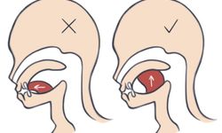 Mewing Nedir, Nasıl Yapılır? Çene Hattını Belirginleştirdiği İddiası Gerçek mi?