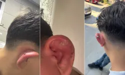 Bursa'da piercing sonrası hastanelik olan çocukla ilgili yeni gelişme! İşletmede hijyen eksiklikleri tespit edildi